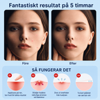 Finnplåster – låt huden återhämta sig i fred