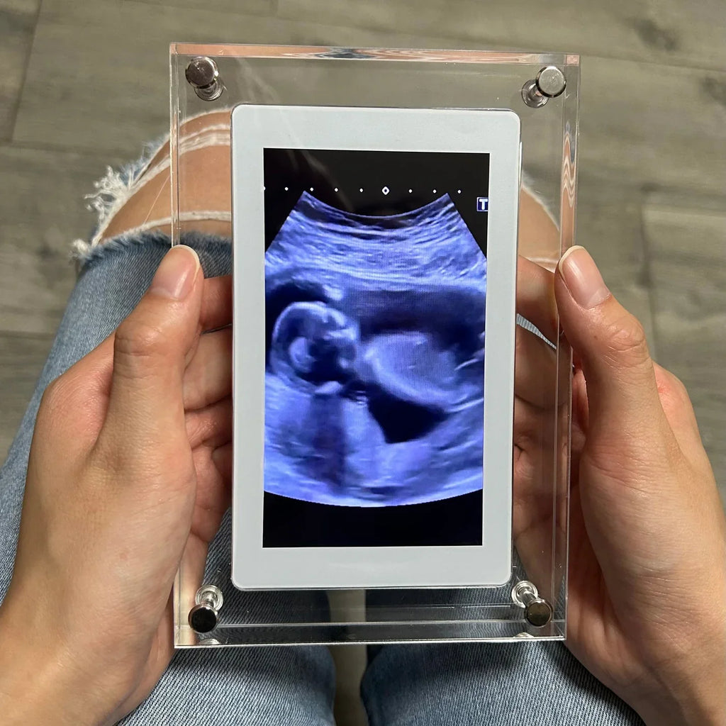 Smart Digital Photo Frame