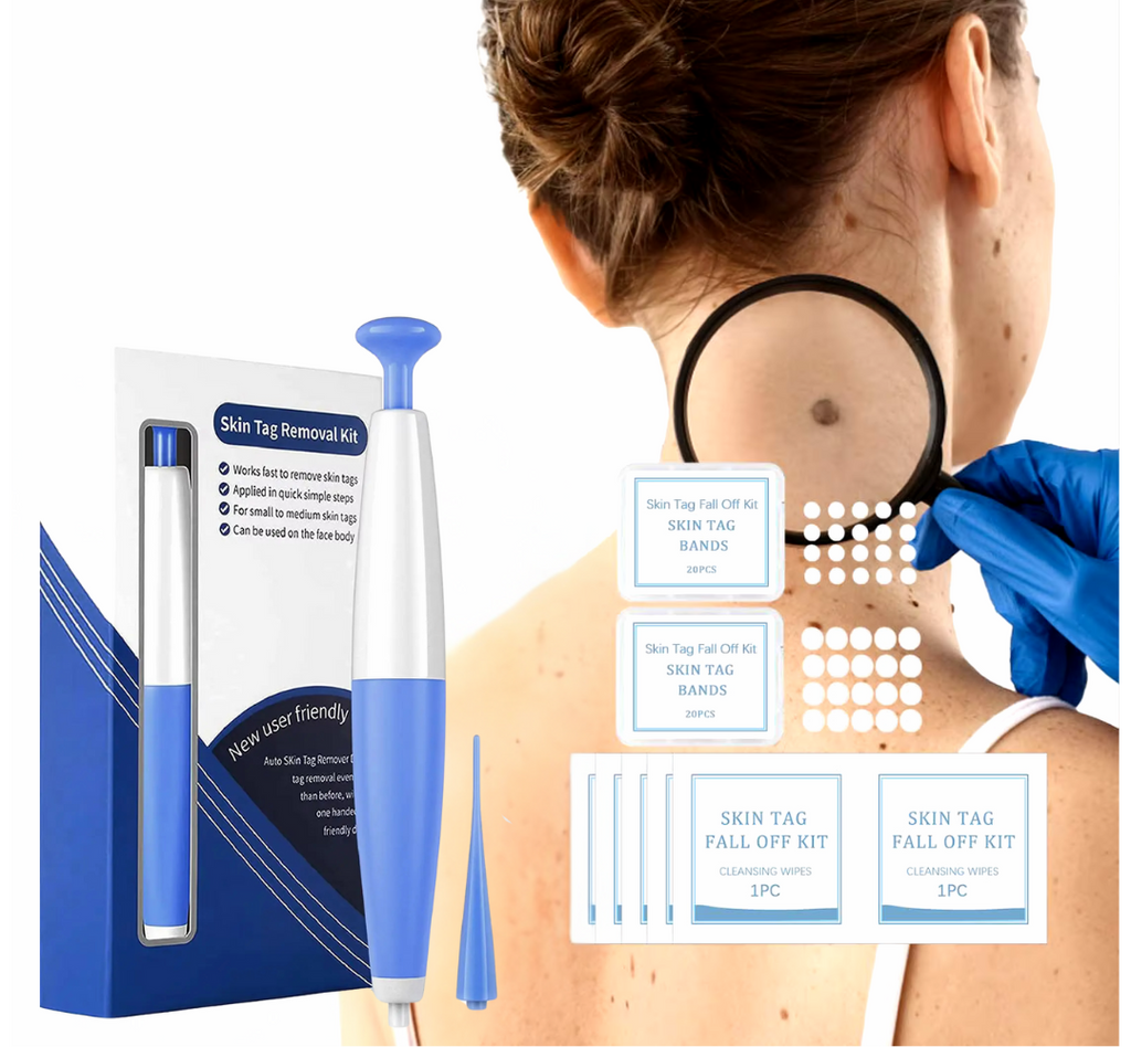 Skin tag removal